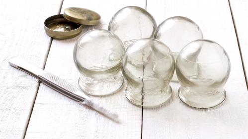 Old medical cupping glass, petrolatum and tweezers with cotton wrapping