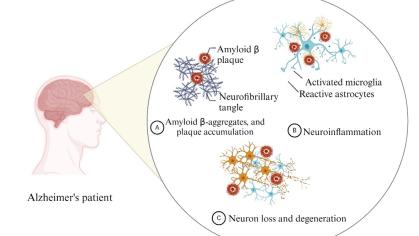 Image for TechAdvance Project Amphiphilic Nanoparticle to Target Amyloid-Induced Microglial Activation