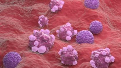 Cancer Cells