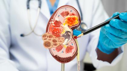 Kidney demonstration by doctor