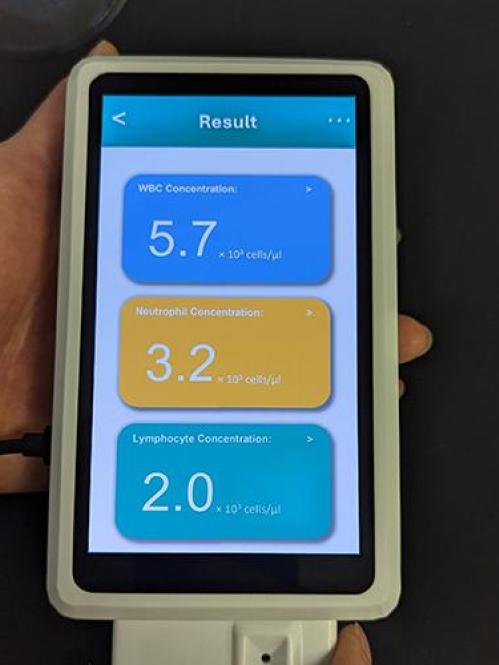 Javanmard White Blood Cell Tracker