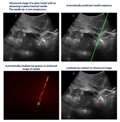 Ultrasound images