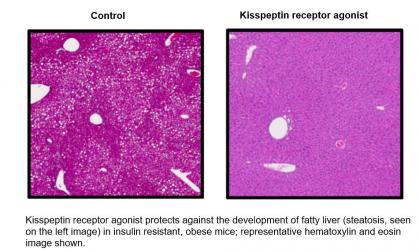 Kisspeptin receptor agonist protects against the development of fatty liver (steatosis, seen on the left image) in insulin resistant, obese mice; representative hematoxylin and eosin image shown