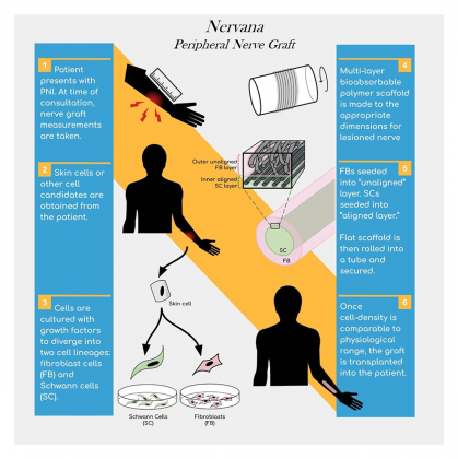 Visual description of Nervana technology