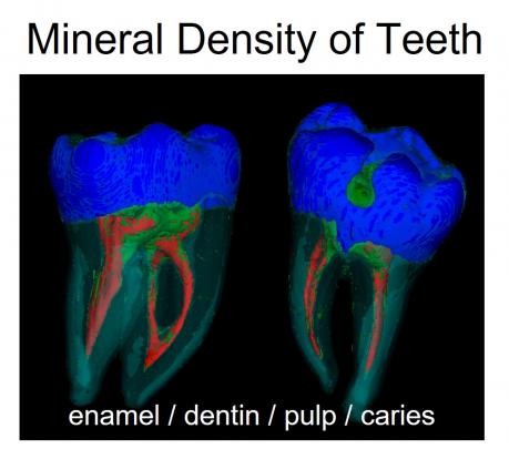 mineral density in teeth